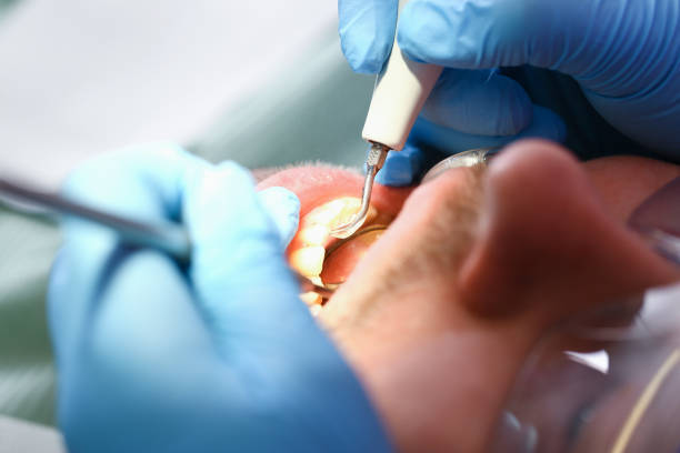 Best Cosmetic Emergency Dentistry in Louisvle, IL