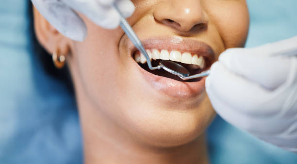 Best Emergency Treatment for Dental Infections or Abscesses in Louisvle, IL